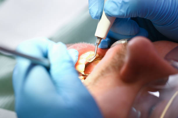 Best Weekend Emergency Dentist in North Rock Springs, WY